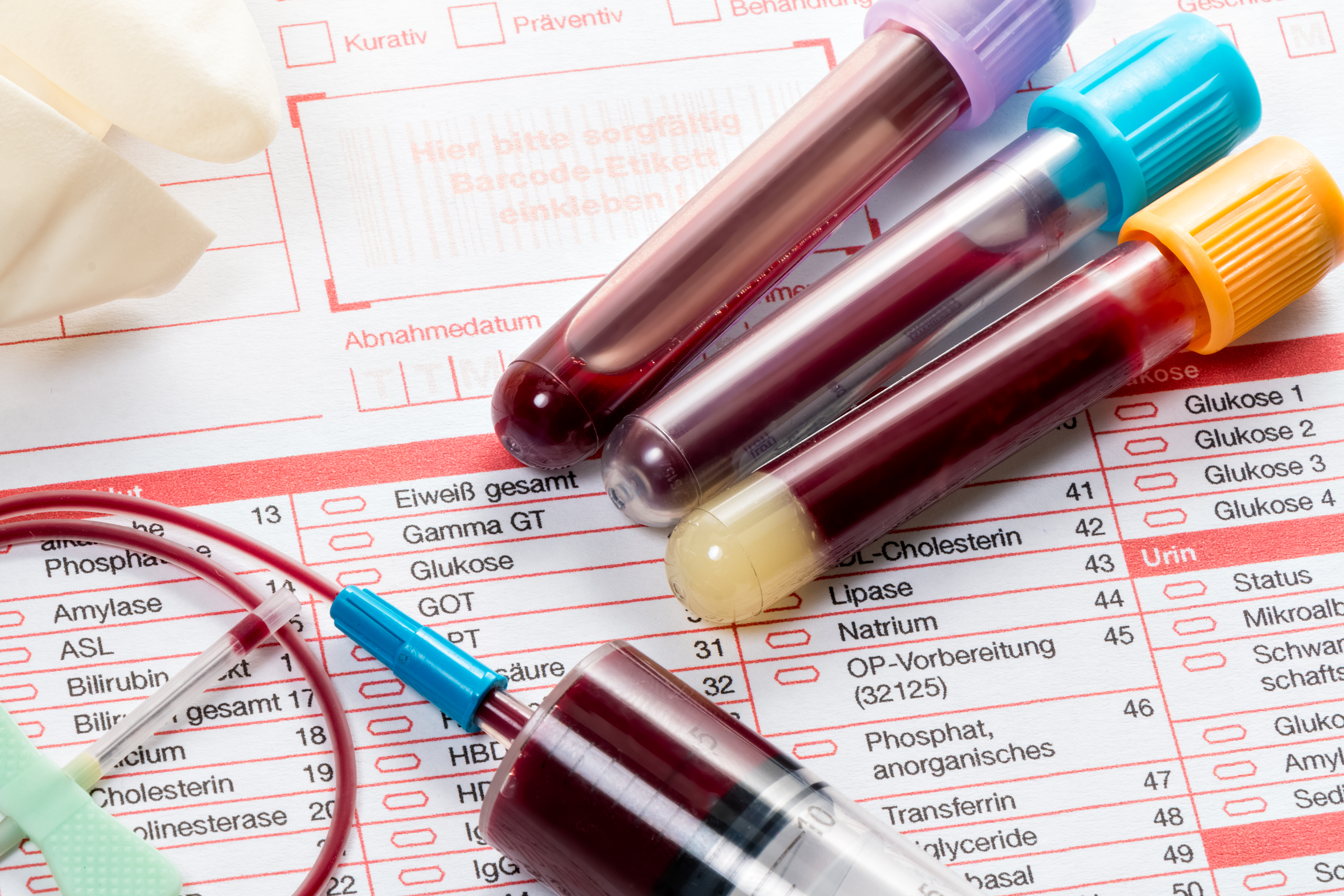 Тест болезни крови. Исследование крови. Клинический анализ крови. Биохимическое исследование крови. Исследование кровли.